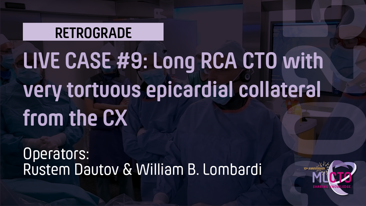 LIVE CASE #9 : Long RCA CTO with very tortuous epicardial collateral from the CX